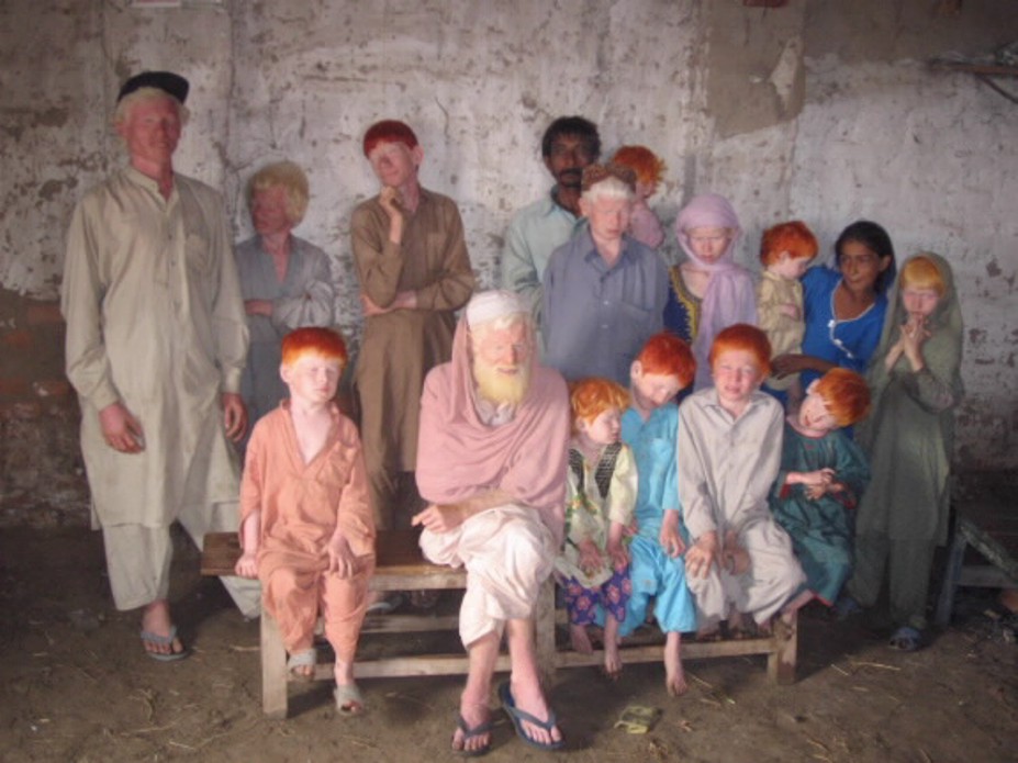 albino indian person