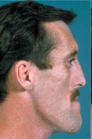 Egyptsearch Forums The First Habsburgs Were Black